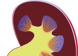 Dietetyczne leczenie kamicy nerkowej kamica nerkowa